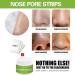 QEEROYO Nose Pore Strips Nose Strips Nose Strips Blackhead Black Head Remover For Nose Blackhead Mask Blackhead Nasal Membranes Head Remover For Nose Blackhead Remover for All Skin Types 30g - Buy Online on GoSupps.com