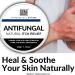 Antifungal Skin Cream - All-Natural Anti-Itch Treatment - For Eczema, Ringworm, Jock Itch, Athlete's Foot & Nail Fungal Infections - 30g - Made In UK - Buy Online on GoSupps.com