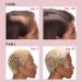 Viviscal Hair Growth Bundle for Women: Supplements for Thicker Hair + Thickening Serum - Buy Online on GoSupps.com