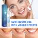 Frosty Neptune Teeth Whitening Kit - 3PCS Essence Pen & Gum Shield Gel for Brightening Smiles | International Shipping - Buy Online on GoSupps.com