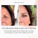 Wonderstripes Invisible Eyelid Tape - Skin-Friendly Eye Lift Strips for Droopy/Hooded Eyes - 64 Medium Silicone Strips (0.16 x 1.02 inch) - Buy Online on GoSupps.com