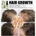 YLYY 30ml Hair Growth Spray Moisturizer | Hair Thickening Products for Women Hair Loss Treatments for Women and Men For Longer Thicker Fuller Hair B:30ml - Buy Online on GoSupps.com