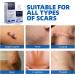 Scar Cream Gel for Face & Body - Effective Treatment for Surgical Scars, Stretch Marks, Acne, Keloids & Burns - 1.05 oz - Buy Online on GoSupps.com