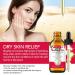SOLOTREE Rosehip Oil 2.02 FL.OZ | Moisturizer for Face & Skin | Nourishing Hair Care | All Skin & Hair Types - Buy Online on GoSupps.com