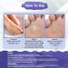 Maximum Strength Wart Remover Liquid with Salicylic Acid - Fast-Acting Wart Treatment for Common Plantar & Genital Warts - 0.68 floz/20ml - Buy Online on GoSupps.com