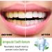Natural Teeth Whitening Serum - Color Corrector for Daily Use Gentle & Tooth-Friendly 10PCS - Buy Online on GoSupps.com