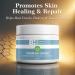 Natural Cream for Psoriasis Relief and Soothing Fast Recovery for Irritated Skin - Buy Online on GoSupps.com