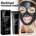 Blackhead Remover Mask - Peel Off Charcoal Face Mask for Deep Cleansing | Acne & Pore Control for Men & Women - Buy Online on GoSupps.com