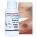 Insect Bites Antivenom Gel | Topical Treatment for Mosquito, Spiders, Snakes, Ants & More | Mineral Silicate University Certified by ALKAVITA - Buy Online on GoSupps.com
