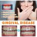 2 Box Gum Repair Treatment Ampoules | Teeth Whitening Serum & Instant Gel for Tartar Removal & Gum Protection - Buy Online on GoSupps.com