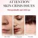 Face Moisturizer for Women - Anti Wrinkle Face Cream - Moisturiser Face Women - 4 in 1 Face Cream - Hyaluronic Acid Ingreients - Deeply Nourishes Skin - Skin Lightening Cream - Buy Online on GoSupps.com