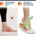 Fixic Arch Support Inserts - 2 Pairs Self-Adhesive Foot Arch Support Pads for Flat Feet - Premium Comfort for All Footwear - Soft Flat Foot Corrector - Improve Your Walking Today - Buy Online on GoSupps.com