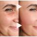 L'effet de levage Instant Anti-Wrinkes express l'essence de la balle rouleaux pour les cernes les poches et les poches la rafale hydratante anti- ge pour les femmes et les hommes (2Pcs) - Buy Online on GoSupps.com