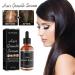 Allurium Hair Growth Serum for Black Women - Anti Hair Loss, Nourish & Repair Dry Damaged Hair - Fast Natural Growth (1PCS) - Buy Online on GoSupps.com