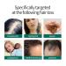 Ginger Anti-Hair Loss Treatment Spray - 30ml Hair Growth Spray for Thinning Hair & Hair Care Essence - Buy Online on GoSupps.com
