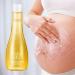 Ranley Oil for Stretch Marks Olive Belly Oil Intensive 52 oz Tightening Natural Moisturizing Pregnant Belly Oil for Stretch Marks - Buy Online on GoSupps.com