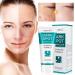 Dark Spot Corrector Cream for Face - Fade Black Precipitates, Remove Freckles & Spots - All Skin Tone Types - Buy Online on GoSupps.com