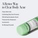 Geologie Clear System Acne Treatment Set Face & Body Wash + Clear Skin Cream + Anti Pimple Pack Salicylic Acid & Retinol Oil Control Breakout Defense Gentle Daily Routine No Benzoyl Peroxide - Buy Online on GoSupps.com