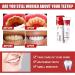 Yayashi SP-4 Probiotic Toothpaste - Natural Tooth Whitener & Brightening CloShpaste for Fresh Breath | All Oral Concerns | 1 PC - Buy Online on GoSupps.com