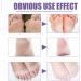 Foot Mask Foot Peel Mask Lavender & VC Exfoliating Foot Peel Mask Lavender Exfoliating Foot Mask Peel Feet Peeling Mask Exfoliating Foot Mask Foot Moisturizing Mask - Buy Online on GoSupps.com