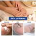 Urea Foot Cream 40 Percent - Urea Cream Plus 2% Salicylic Acid - Cracked Heel Repair Cream - Urea Cream for Feet with Coconut Oil Tea Tree and Aloe Vera - Callus Remover and Soften - Buy Online on GoSupps.com