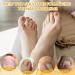 30ml Ingrown Toenail Treatment Drop Natural Ingrown Toenail Correction Oil Cuticle Care Oils for Toe Fungal Nail Treatment Trimming Nail Softening Drop Extra Strong for Damaged Nails - Buy Online on GoSupps.com