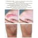 Vibrant Glamour Cayman Repair Gel: Acne Scar & Skin Scar Removal Ointment - 20g - Buy Online on GoSupps.com