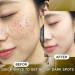 Tranexamic Acid Serum Tranexamic Acid Skin Brightening Serum Dark Spot Correcting Glow Serum Moisturiser For Acne Prone Skin with Hyaluronic Acid Arbutin Hyperpigmentation and Even Skin Tone - Buy Online on GoSupps.com