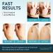 Silicone Scar Sheets - Effective Scar Removal & Tummy Tuck Treatment (4 Packs) - Buy Online on GoSupps.com