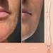 Brandluxe Dermaplaning Tool - Face & Eyebrow Shaping, Hair Removal & Exfoliation Razor (Rose Gold +2 Heads) - Eco-Friendly Design for Women - Buy Online on GoSupps.com