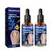 German Toenailcare Removal Paronychia Oil, Nail Renewal Liquid for Damaged & Discoloration Nail,Toenail Treatment Oil for Repair and Improve Toenail Health-2pcs