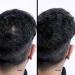 Super Million Hair Fibers - High-Quality Light Gray Hair Thickening - 15g | International Shipping Available - Buy Online on GoSupps.com