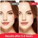 Original Hydrocolloid Acne Pimple Patch - Invisible Spot Stickers for Face & Skin Perfect for Teens - Blemish Coverage & International Shipping - Buy Online on GoSupps.com