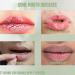Lip Balm Lips Pink Bleaching Cream Balm Lip Lightening for Dark Lips Lip Care Lightens Remove Dark Lips Moisturizing Lip Balm Whitening & Brightening Lip Balm Stick for Women Scented Lip Balm - Buy Online on GoSupps.com