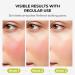 RoowLtne 2% Salicylic Acid Serum for Face: Acne & Blackhead Remover, Pore Reducer for Oily & Acne Prone Skin, Gently Exfoliating Facial Serum with Witch Hazel, 1.01 Fl Oz - Buy Online on GoSupps.com