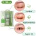200 Pairs Natural Invisible One Side Eyelid Tape Stickers | Waterproof Breathable Self-Adhesive Eye Lift Strips - Instant Results, No Surgery | Ideal for Uneven, Droopy, Hooded Eyelids - Buy Online on GoSupps.com