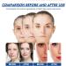 S rum Anti-Taches de Rousseur S rum Correcteur de Taches Serum Anti Tache Visage S rum pour les Taches de Rousseur S rum Visage Anti- ge claircissante pour la Peau S rum Hydratant 30ml - Buy Online on GoSupps.com