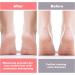 Buy Silicone Socks for Dry Cracked Feet - Thickened Moisturizing Foot Mask & Exfoliating Spa Gel Socks - 2 Pairs for Women | International Shipping Available - Buy Online on GoSupps.com