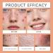 FFEEJ Mousse Cleanser Gentle Facial Cleansing Foam - Soothing Exfoliating Pore Unclogging Face Wash - Buy Online on GoSupps.com