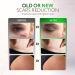 Silicone Scar Sheets Roll (1.6 x 120) - 3M for Post Surgery Treatment | C-Section, Tummy Tuck, Keloid, Acne | Painless Removal - Buy Online on GoSupps.com