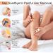 Crystal Hair Remover Canvalite Painless Magic Crystal Hair Eraser for Women Washable Reusable Skin Exfoliating Hair Removal Stone for Women Men Unique Shape Hair Shaver for Arms Legs Body(Gold) - Buy Online on GoSupps.com