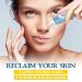 Advanced Silicone Scar Gel for Keloid Bump Removal & Treatment - Nose, Ear, Belly Piercings, Stretch Marks, Burn, Surgical, C-Section, Old & New Scars - Buy Online on GoSupps.com