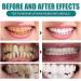 Tooth Repair Stain Remover Ampoules - Essence Toothpaste & Serum for Deep Cleaning Gums | Fresh Breath (3 Box) - Buy Online on GoSupps.com