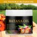 Batana Oil 2 Pack Organic Natural Batana Oil for Hair Growth Improves Natural Hair Growth Prevents Hair Loss and Split Ends Suitable for All Hair Types - Buy Online on GoSupps.com