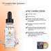 Acne Clearing Face Serum - Natural Anti-Aging Formula for Wrinkles Blemishes & Bright Skin | Effective Cystic Acne Treatment - Buy Online on GoSupps.com