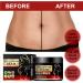 Cr me pour varices limination des varices r parateur de varices cr me pour varices jambes varices enflamm es 20 g 1 pi ce - Buy Online on GoSupps.com