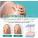 IBUGER Scarremove Advanced Scar Spray - Medical Grade Scar Remover for All Types of Scars | 1pcs - Buy Online on GoSupps.com