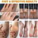 Cr me l'ur e 60 Percent pour les pieds ur e et miel - Buy Online on GoSupps.com