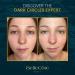 Skin Moisturizer Brightening Face Cream | Hyaluronic Acid & Vitamin C+E for Rosacea & Anti-Aging | Instant Wrinkle Filler & Hydrating Treatment - Buy Online on GoSupps.com
