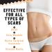 Silicone Scar Patches - Effective Gel Sheets for Scar Removal Acne Surgery & Stretch Marks - 5 Gentle Care Sheets - Buy Online on GoSupps.com